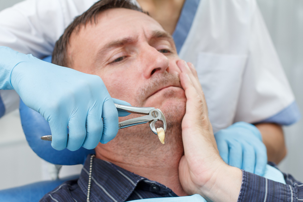 Tooth Extractions & Wisdom Teeth Removal