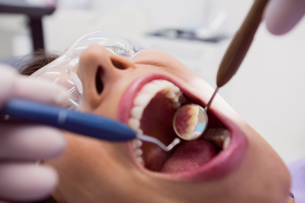 Fillings & Cavities Treatment